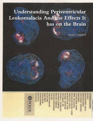 Book cover for Understanding Periventricular Leukomalacia And the Effects It has on the Brain