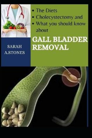 Cover of The Diets, Cholecystectomy, And What You Should Know About Gall Bladder Removal