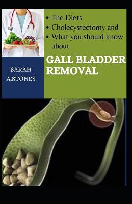 Book cover for The Diets, Cholecystectomy, And What You Should Know About Gall Bladder Removal