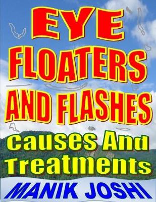 Book cover for Eye Floaters and Flashes: Causes and Treatments