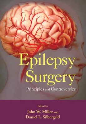 Cover of Epilepsy Surgery