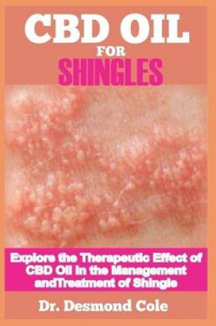 Cover of CBD Oil for Shingles