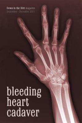 Book cover for Bleeding Heart Cadaver