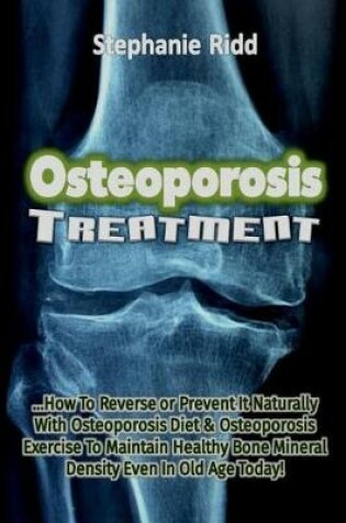 Cover of Osteoporosis Treatment