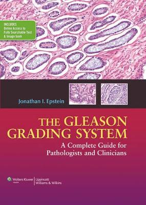 Book cover for The Gleason Grading System