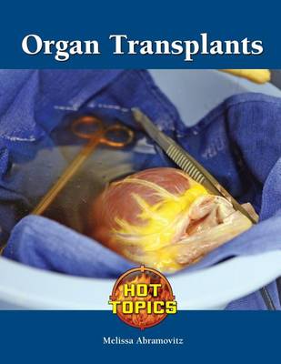 Cover of Organ Transplants