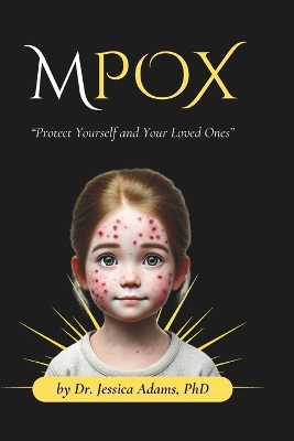 Book cover for Mpox