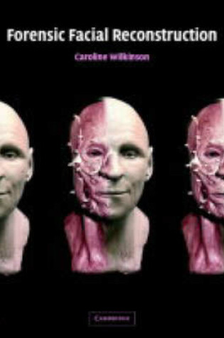 Forensic Facial Reconstruction