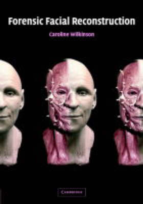 Book cover for Forensic Facial Reconstruction