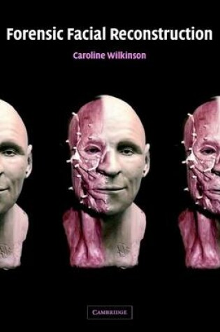 Cover of Forensic Facial Reconstruction