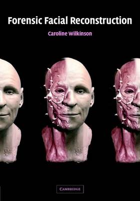 Book cover for Forensic Facial Reconstruction