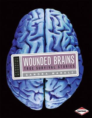 Book cover for Wounded Brains