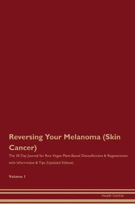 Book cover for Reversing Your Melanoma (Skin Cancer)