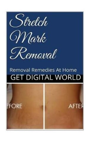 Cover of Stretch Mark Removal