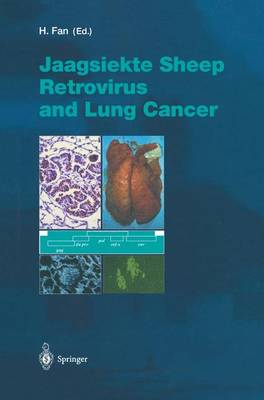 Cover of Jaagsiekte Sheep Retrovirus and Lung Cancer