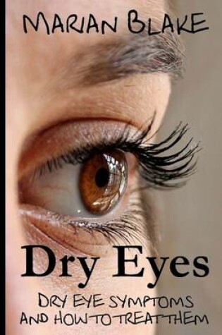 Cover of Dry Eyes