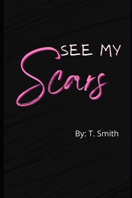 Book cover for See My Scars