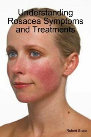Cover of Understanding Rosacea Symptoms and Treatments