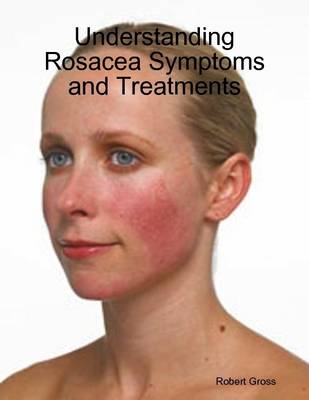Book cover for Understanding Rosacea Symptoms and Treatments