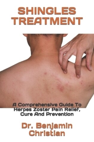 Cover of Shingles Treatment