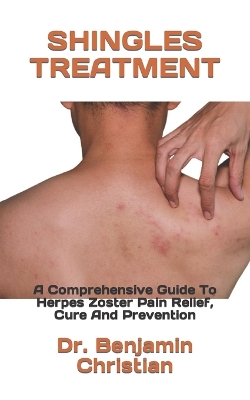 Book cover for Shingles Treatment