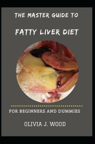 Cover of The Master Guide To Fatty Liver Diet For Beginners And Dummies