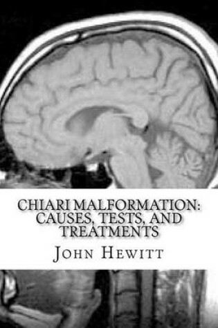 Cover of Chiari Malformation