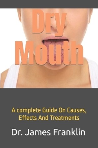 Cover of Dry Mouth