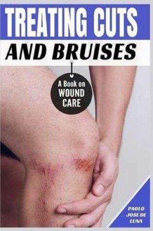 Cover of Treating Cuts and Bruises