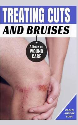 Book cover for Treating Cuts and Bruises