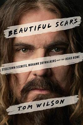 Book cover for Beautiful Scars