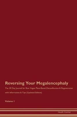 Book cover for Reversing Your Megalencephaly