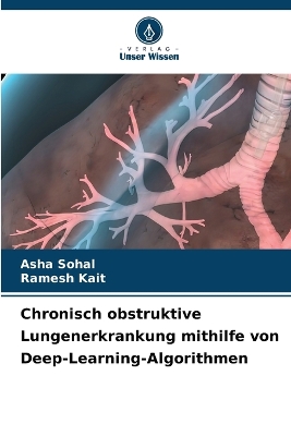 Book cover for Chronisch obstruktive Lungenerkrankung mithilfe von Deep-Learning-Algorithmen