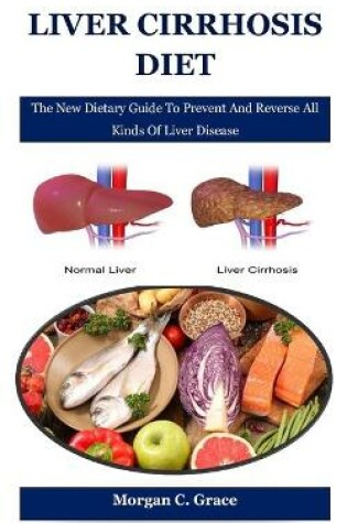 Cover of Liver Cirrhosis Diet