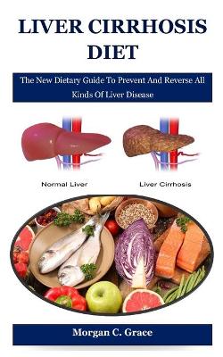 Book cover for Liver Cirrhosis Diet