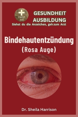 Book cover for Bindehautentzündung (rosa Auge)