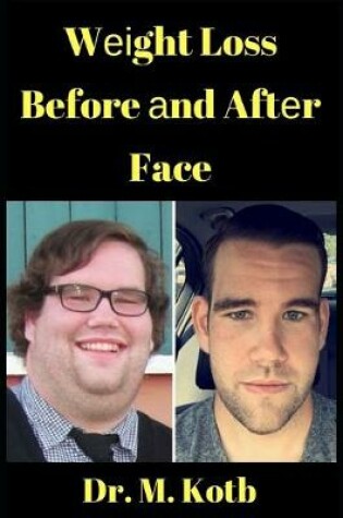 Cover of Weight Loss Before and After Face