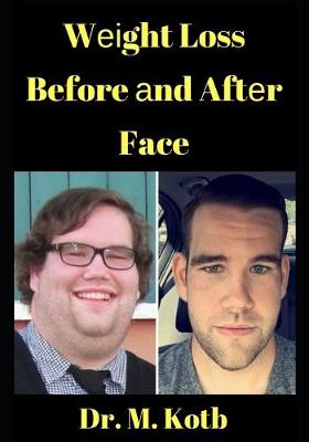 Cover of Weight Loss Before and After Face