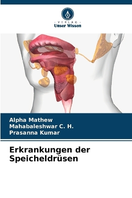 Book cover for Erkrankungen der Speicheldrüsen