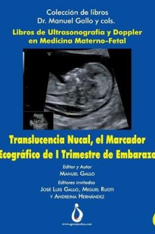 Cover of Translucencia Nucal, El Marcador Ecografico de I Trimestre de Embarazo
