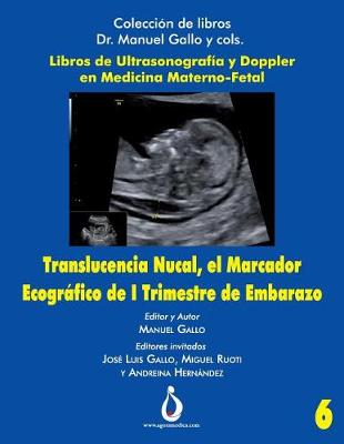 Book cover for Translucencia Nucal, El Marcador Ecografico de I Trimestre de Embarazo