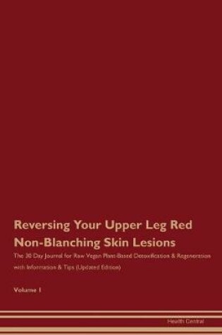 Cover of Reversing Your Upper Leg Red, Non-Blanching Skin Lesions