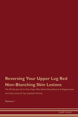 Book cover for Reversing Your Upper Leg Red, Non-Blanching Skin Lesions