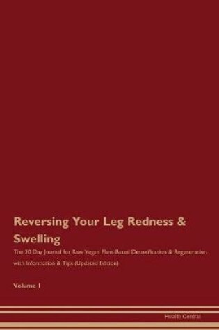 Cover of Reversing Your Leg Redness & Swelling