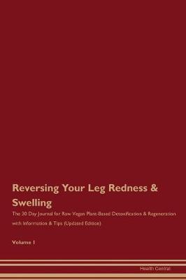 Book cover for Reversing Your Leg Redness & Swelling