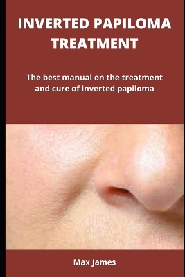 Book cover for Inverted Papiloma Treatment