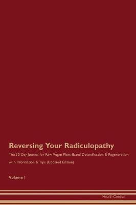 Book cover for Reversing Your Radiculopathy