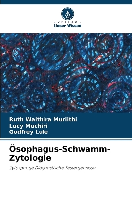 Book cover for Ösophagus-Schwamm-Zytologie