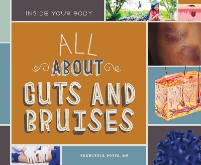 Book cover for All about Cuts and Bruises