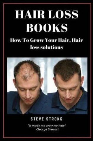 Cover of Hair Loss Books